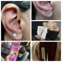 پیرسینگ درما پاکسازی موخوره آموزش درما