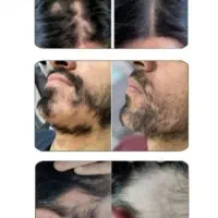 محصول وارداتی