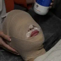 پاکسازی پوست