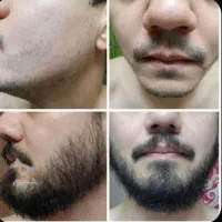 با ما ریشو میشی