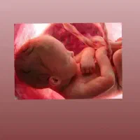 نیازمند رحم اجاره ای
