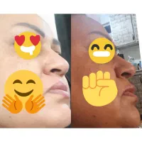 کرم/رفع جوش و لک/سفیدکنندگی دائمی/ضمانت بازگشت وجه