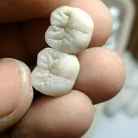 پودرگذار و کارآموز مسلط به قالبریزی درلابراتوار|استخدام درمانی، زیبایی، بهداشتی|تبریز, |دیوار
