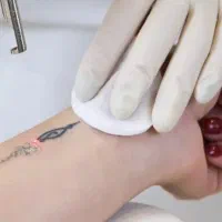 پاک کردن انواع تاتو وخالکوبی با لیزر کیوسویبچ 2025