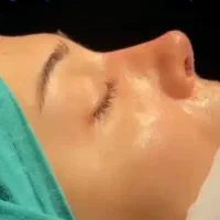 عمل جراحی زیبایی بینی،اندام،پلک