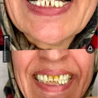 دندانپزشکی و ایمپلنت،تعرفه دولتی،بیمه،اقساط در صدرا-فارس، فاز ۱