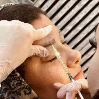 کاشت مو ژل بوتاکس فیلر لیزر با تسویه اقساطی