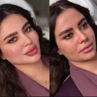 فیلر و بوتاکس کانتورینگ  فیلر لب فیلر بینی لاغری