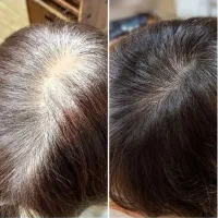 برای همیشه رفع سفیدی