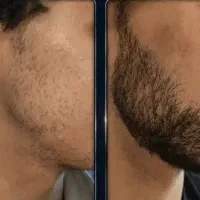تخفیفات ویژه تغییر قیمت فرصت تا آخر ماه