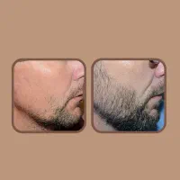 20روزه|آرایشی، بهداشتی، درمانی|بیرجند, |دیوار