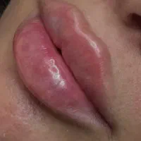 خدمات زیبایی ژل و بوتاکس