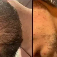 با من ریش دار شو