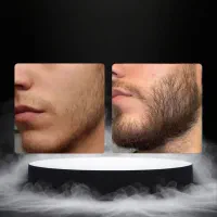 دیگه بی فیس نیستی