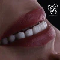 جشنواره ویژه تابستانه دندانپزشکی دکتر خدابنده