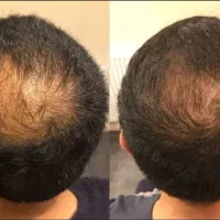 با روش جدید دغدغه هاتو از بین ببر