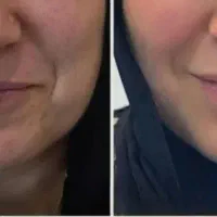 کرم بیوممتیک