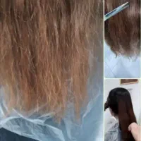 موخوره گیری، و تراپی مو 298، بافت مو 268