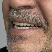 پروتزیست دندان علی نیکو