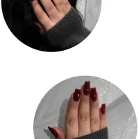 کاشت ژل، ترمیم،