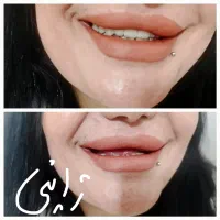 دندانسازی ایرانمنش، تامین اجتماعی، نقد و اقساطی