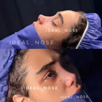 جراحی عمل بینی *نقدی و اقساط*
