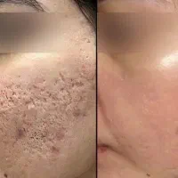 رنگ|خدمات زیبایی و سلامت|زابل, |دیوار