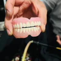 ست دندان مصنوعی طرح لبخند