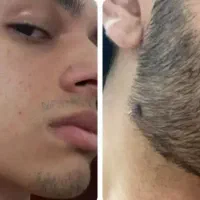 از کمپشتی تا ریشِ فرماندهی