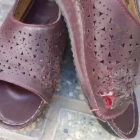تعویض کفش گرفتارم ارتروز دارم با اسکاجودستگیره