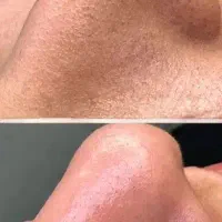 فیشیال