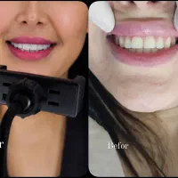 مرکز دندانپزشکی اسپی دنتال