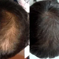 موهات مثل جنگل پرپشت میشه