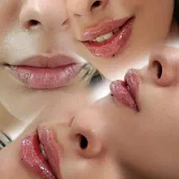 تزریق ژل فیلر بوتاکس مزوژل مزوتراپی جوانساز