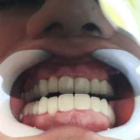 خدمات دندان پزشکی آرامش(اقساط بلند مدت)