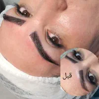جشنواره عیدانه ۴۰٪تخفیف+پی ارپی رایگان کاشت ابرو