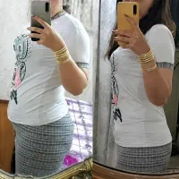 تنها و بهترین روش لاغری ونتیجه قطعی باکرایولیپولیز