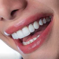 کامپوزیت دندان /زیبایی/ایمپلنت/ترمیمی/ عصب کشی