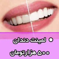 لاینو مکسFP
