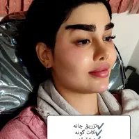 ژل صورت ولب بوتاکس آنزیم (تخفیف ویژه عید)