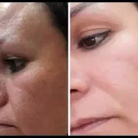 با کرم معجزه مثل الماس بدرخش
