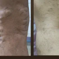 مرکز تخصصی درمان واریس