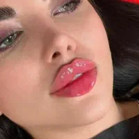 کلینیک ژل لب فیلرزیرچشم،شقیقه، بوتاکس، فیلربادی