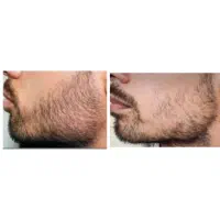 ریشات از موهات بلند تر میشه