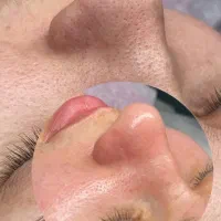 فیشیال و پاکسازی