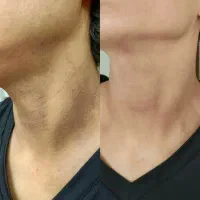 فروش انواع محصولات سفیدکننده چاقی و لاغری