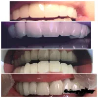 خدمات دندان پزشکی آرامش(اقساط )