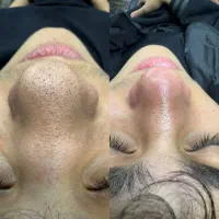 فیشال روشن سازی پوست صورت و بدن پدیکور پروتز مو