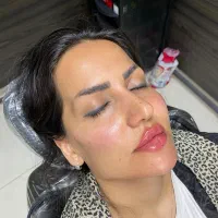 مرکز تخصصی فیلر و بوتاکس ژل نخ فیلر بیکینی