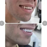 (شروع10خرداد) آموزشvipکامپوزیت و اشتغال